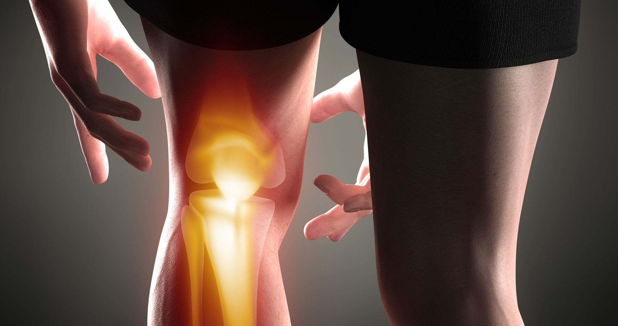 ACL injury - Sydney Sports Physio & Rehab